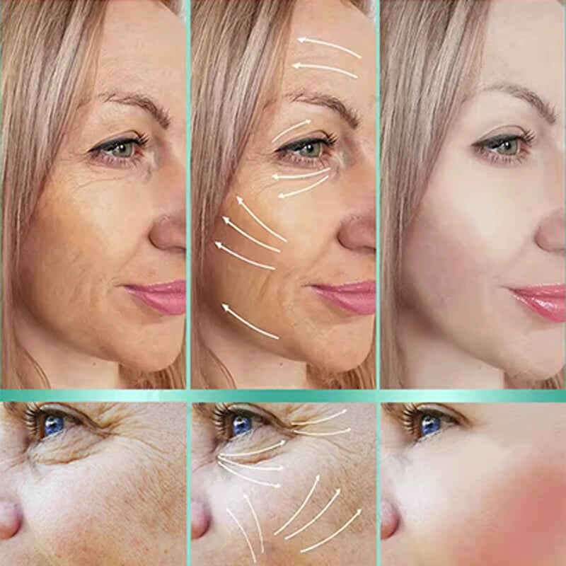 Instant Lift Bee Venom Cream