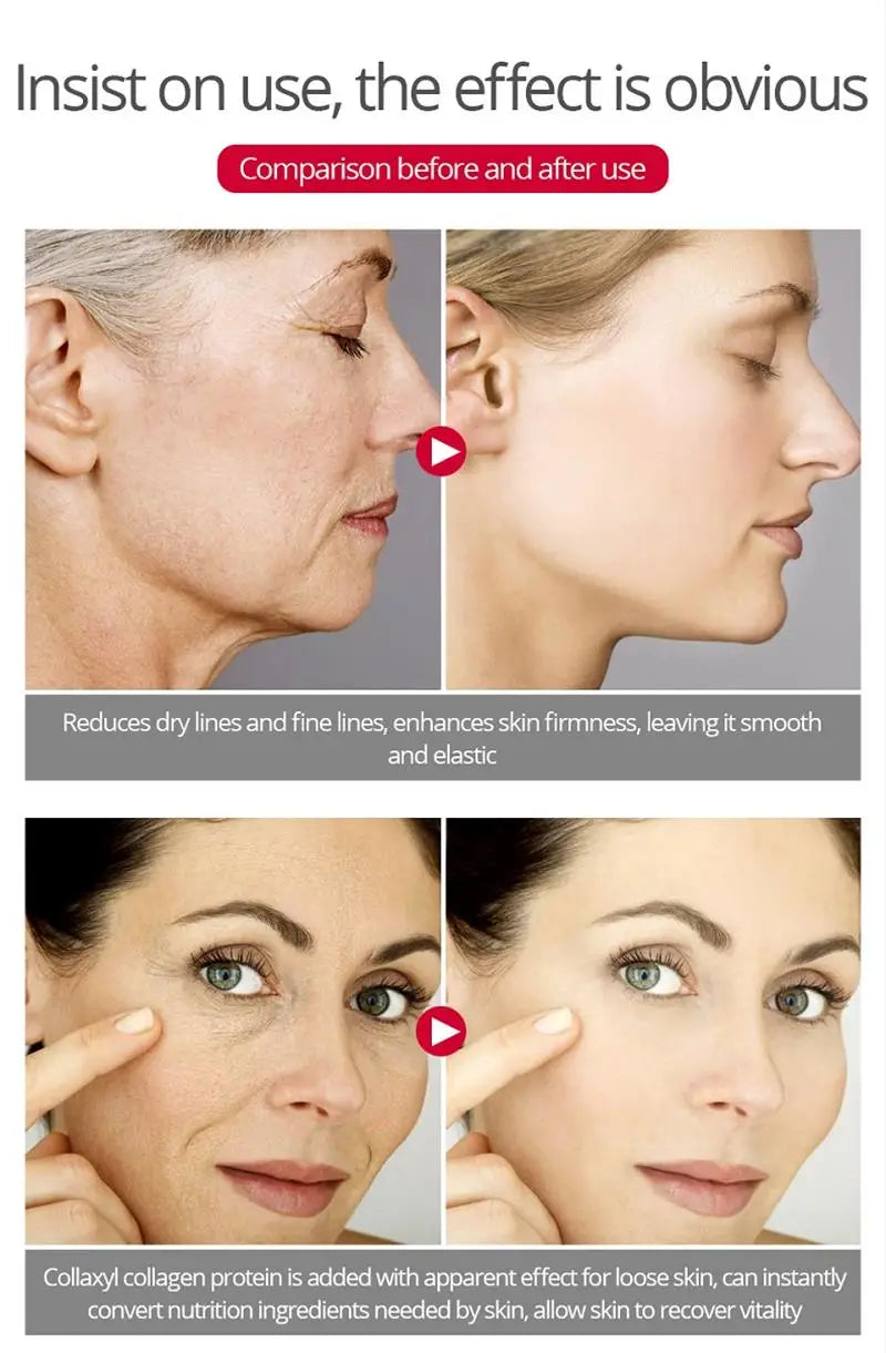 Instant Lift Bee Venom Cream