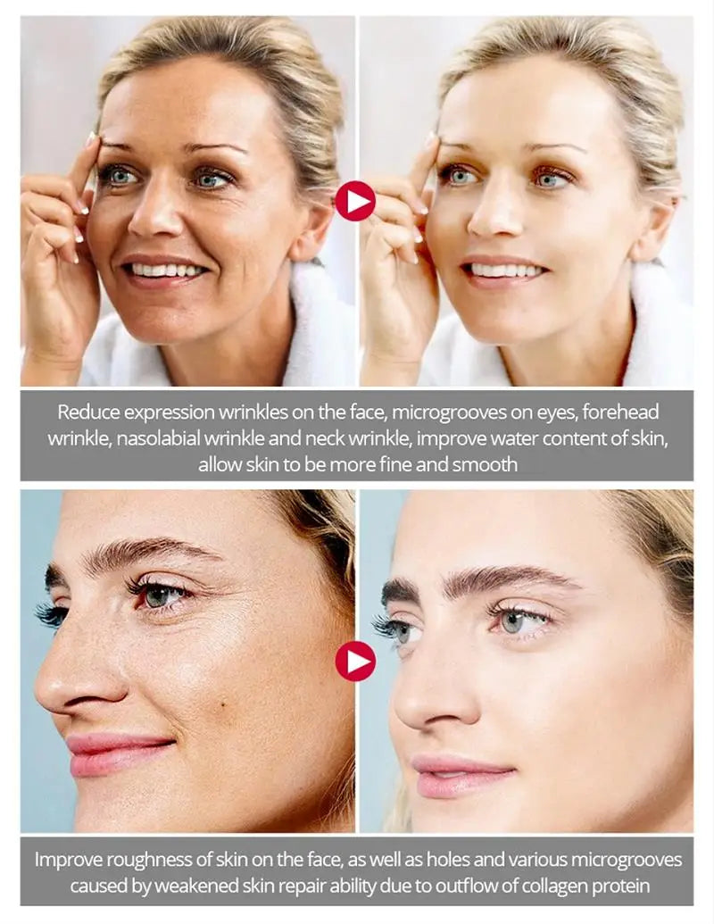 Instant Lift Bee Venom Cream
