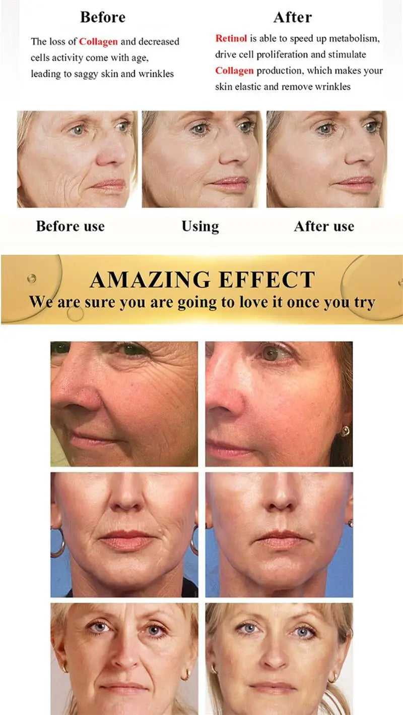 Instant Lift Bee Venom Cream